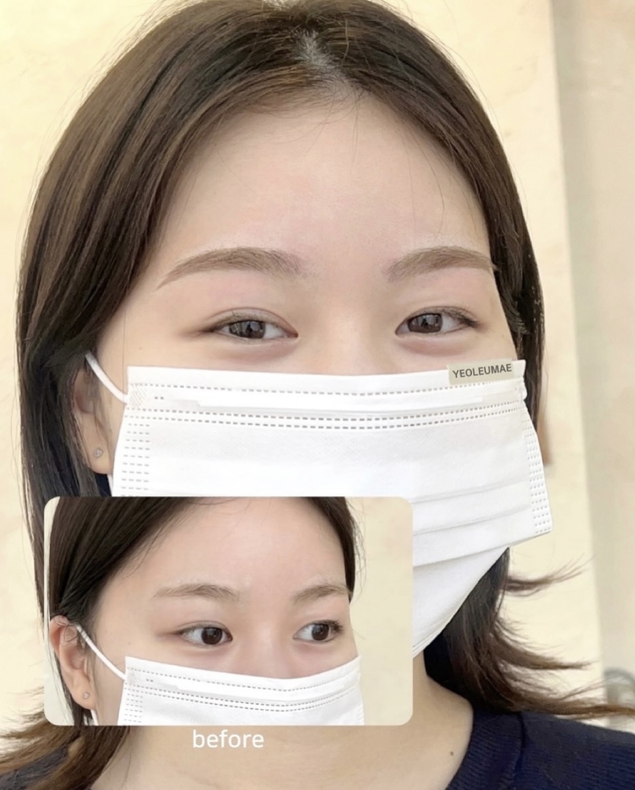 섀도우 눈썹 정면 전후 비교